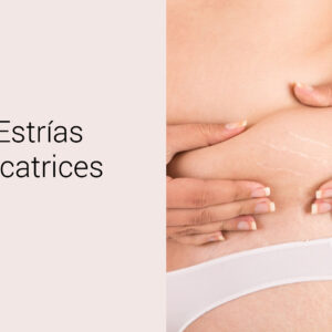 cicatrices